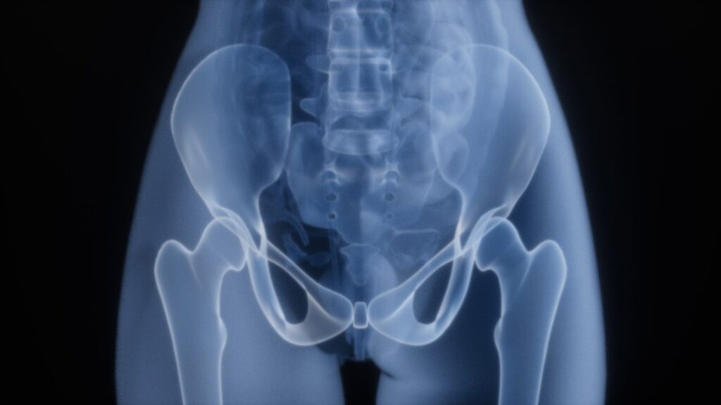 X-ray of a human pelvis and hips