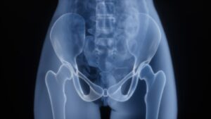 X-ray of a human pelvis and hips